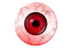 Auge rot - Augenarzt aufsuchen