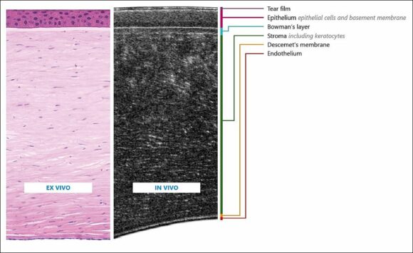 OCT Aufnahme c Oculus Optikgeraete