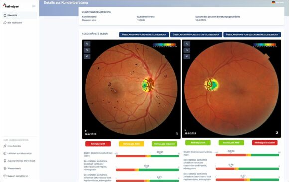RetinaLyze Konsultation Software