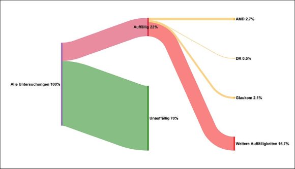 Ocumeda Screenshot Auffaelligkeiten KI Screening