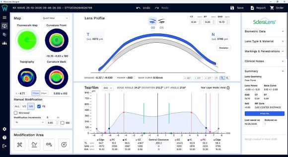 Wave Software CAD-CAM-System c Wave Contact Lens System